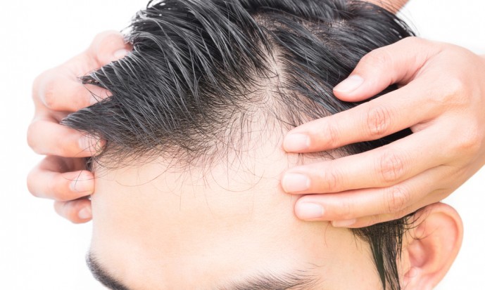 薄毛男性におすすめしたい髪型
